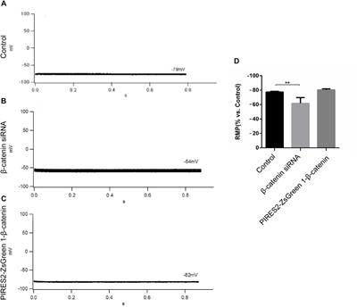 β-Catenin Controls the Electrophysiologic Properties of Skeletal Muscle Cells by Regulating the α2 Isoform of Na+/K+-ATPase